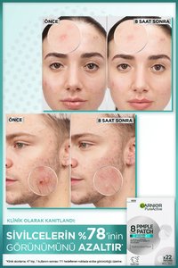 Şeffaf Sivilce Bandı